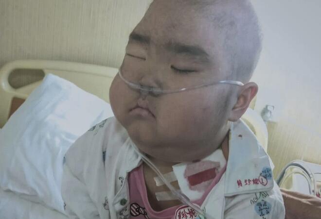 7岁女童4年抗癌2次险要命 今被医生禁食3个月 饿的咬妈妈.jpg