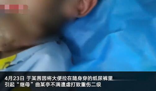 黑龙江4岁受虐女童获6万元司法救助 追责与救济&ldquo;两不误&rdquo;.jpg
