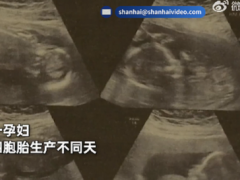 山东一孕妇身怀四胞胎生产不同天，网友：希望平安！