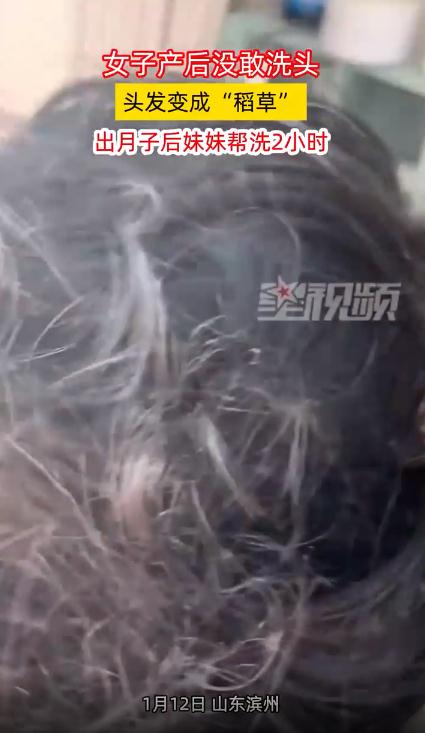 女子产后不洗头 头发变成&ldquo;稻草&rdquo;