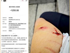 游客在重庆南山被野猴抓伤 景区提醒勿投喂野生动物【热搜】