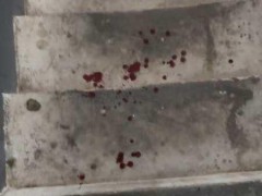 男子斥责不拴绳遭狗主人打还被尾随 狗主人已被刑拘【热搜】