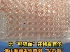 广东顺德发现一例钻石血 稀有度超熊猫血百倍【热搜】