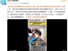 网红郭聪明剃光头发准备手术 内幕曝光让人意外！