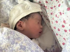 27天婴儿治疗黄疸时死亡 监控揭示真相[热点]