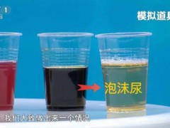 喝水后的5个异常可能是身体求救信号 警惕肾脏问题[热点]